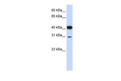 OVOL2 Rabbit anti-Human, Polyclonal, Novus Biologicals 0.1 mL; Unconjugated:Antibodies,